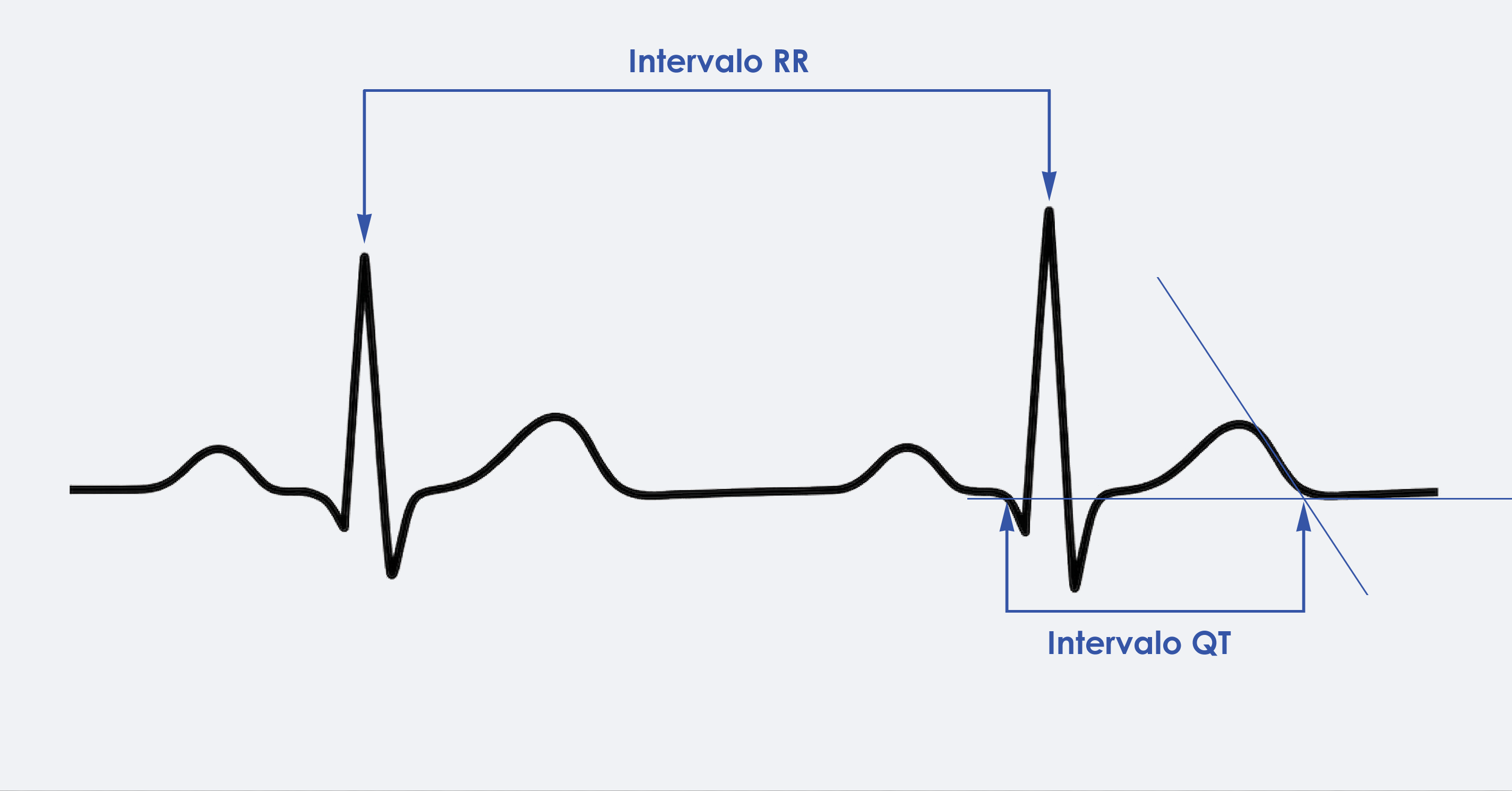 Esquema Medición QT